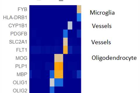 EBV the solution for MS is found or is it?