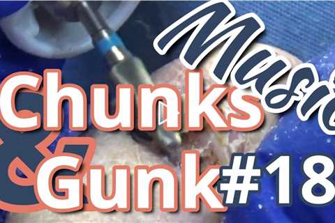 Chunks and Gunk #18 Music (2022)