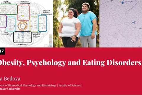 Obesity, Psychology and Eating Disorders