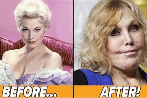 Celebrities Who Destroyed Their Looks with Plastic Surgery