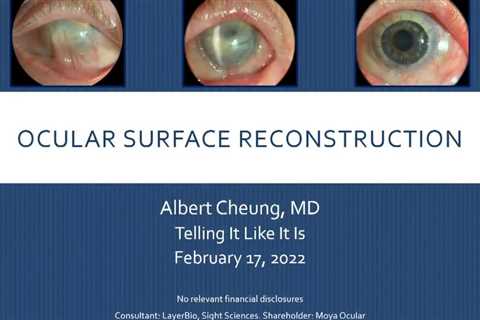 VIDEO: Stem cell transplantation an option for ocular surface reconstruction