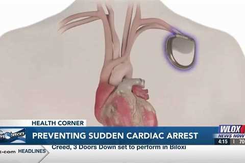 Health Corner: Preventing sudden cardiac arrest