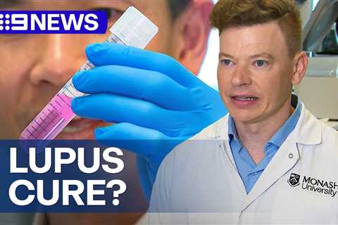 Australian Researchers Find Potential Lupus Cure