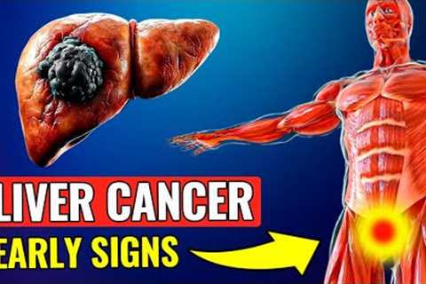 14 SYMPTOMS OF LIVER CANCER | 57