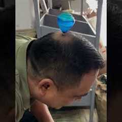 Spinning Toy On Balding Head