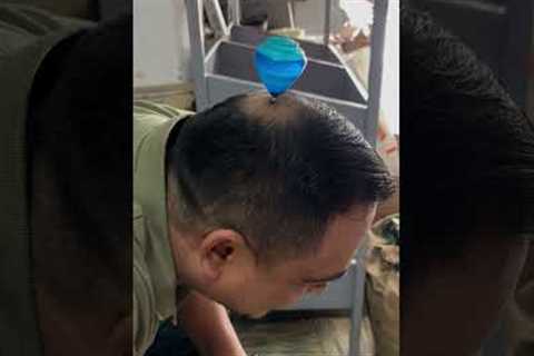 Spinning Toy On Balding Head