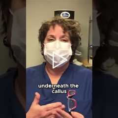 Unusual Callus Mystery What Could Have Cause #MedicalMystery #Callus #UnexpectedFind