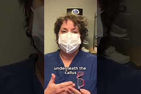 Unusual Callus Mystery What Could Have Cause #MedicalMystery #Callus #UnexpectedFind