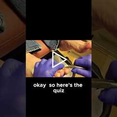 Daily Foot Checks A Diabetic's Routine! #diabetic  #footcare