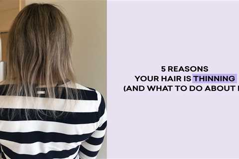 Hair Loss Causes and Top Treatments for Beautiful Hair