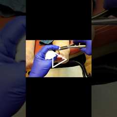Dealing with Gout A Finger Issue  #GoutAwareness #HealthTips #UnexpectedSymptoms