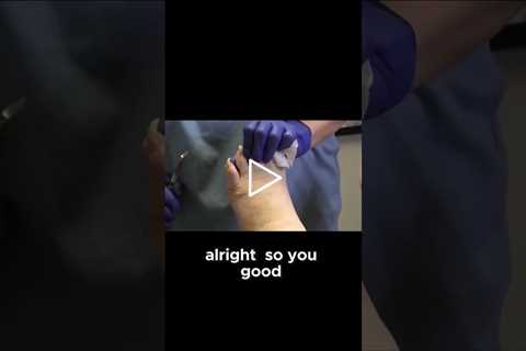 Why You Shouldn't Skip Your Toenail Appointments!