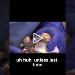 Watch How Thick Toenails Are Trimmed Without Pain #ToenailCare #FootHealth #NailTrim