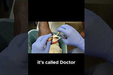 Meet Doctor Nail Nipper!