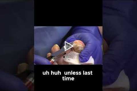 Watch How Thick Toenails Are Trimmed Without Pain #ToenailCare #FootHealth #NailTrim
