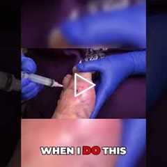 Understanding Gout Symptoms and Causes