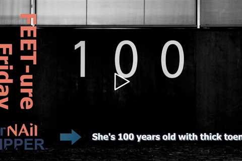 FEET-ure Friday |  She's 100 years old with thick toenails