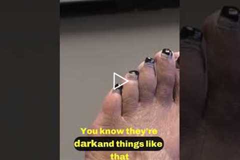 Unique Perspectives on Male Toenail Polish 🎨