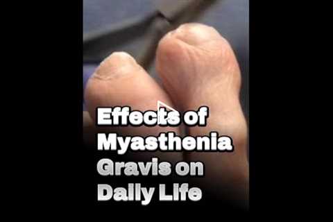 Effects of Myasthenia Gravis on Daily Life | Living With MG: Fatigue & Speech Struggles 😮‍💨🗣️