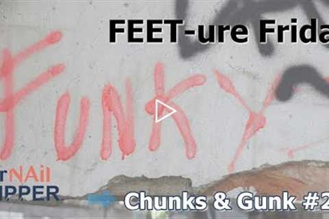 FEET-ure Friday | Genetic Calluses & Thick Nail Trimming | Podiatrist Explains | Chunks & Gunk #27