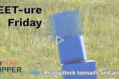 FEET-ure Friday | Really thick toenails and a corn