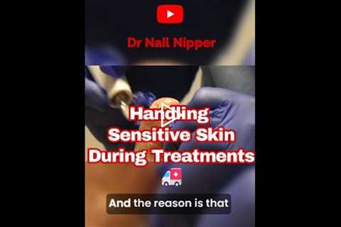 Why Some Nail Fungus Treatments Don’t Work 🚑