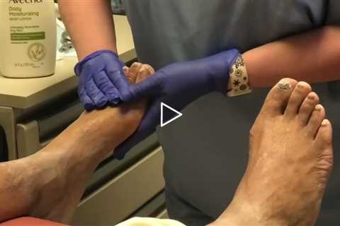 Why Nail Fungus Treatments Fail — Plus Real Talk About Consistency & Care