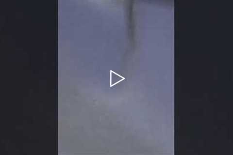 Try this trick to stay calm during a pedicure #pedicure #podiatrist #nails