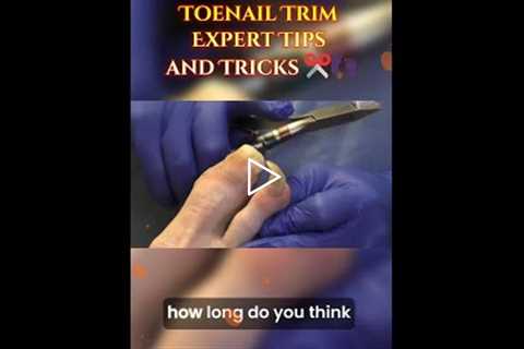 Navigating the Toenail Trim Expert Tips and Tricks ✂️👣
