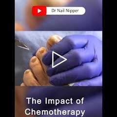 The Impact of Chemotherapy on Immunity