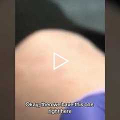 Foot Care Essentials: Pads, Pressure Relief & Painful Corn Treatment