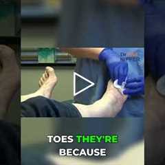 Are Arch Supports Really Necessary for Foot Pain? 👣