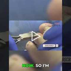 Post-Storm Mold Nightmare: Can This Florida House Be Saved?