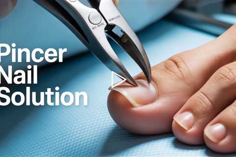 Pincer Toenails Explained | Why These Nails Hurt & How We Treat Them – Dr Nail Nipper