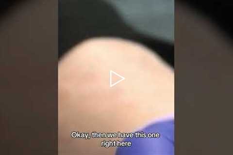 Foot Care Essentials: Pads, Pressure Relief & Painful Corn Treatment