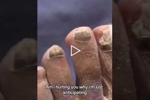 Nervous About Foot Treatment? You’re Not Alone.