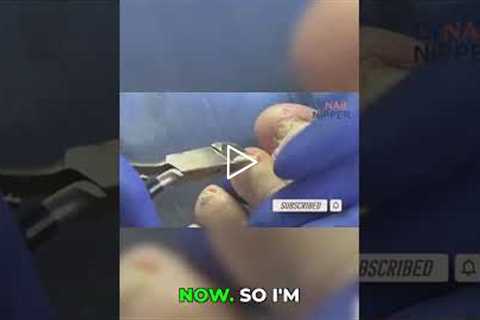 Post-Storm Mold Nightmare: Can This Florida House Be Saved?