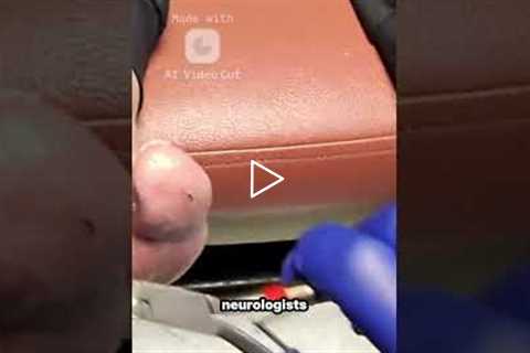 If this cured neuropathy, win Nobel Prize | Can Neuropathy Be Reversed? A Podiatrist’s Honest Answer