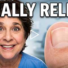 Watch Dr. Nail Nipper transform damaged nails | You Won’t Believe This Conversation Then Toenails..