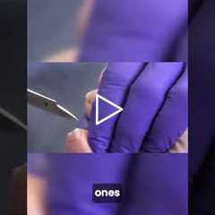 Birthday Wings & Toenail Care 🍗 | You’ll Love This Patient!