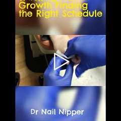 Tracking Nail Growth Finding the Right Schedule