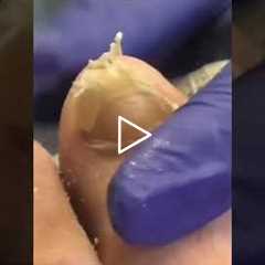 Pre-Diabetic to Healthier Her Amazing Weight Loss Journey | Lost 25 lbs… But Foot Pain Comes Back?