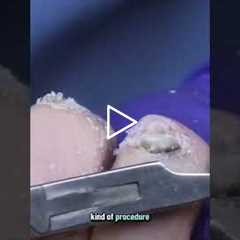 Revolutionary Vascular Procedures Healing from Within