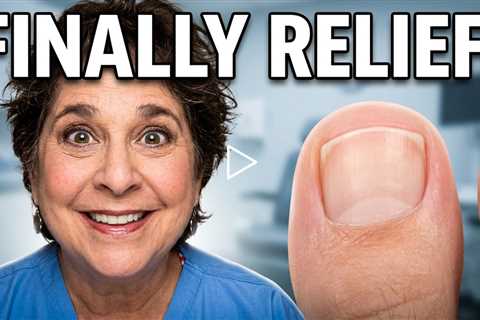 Watch Dr. Nail Nipper transform damaged nails | You Won’t Believe This Conversation Then Toenails..