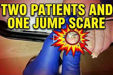 FEET-ure Friday | Two Patients and One Jump Scare