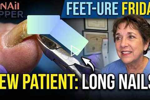 FEET-ure Friday | New Patient, Long Nails