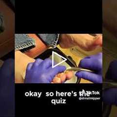Daily Foot Checks A Diabetic's Routine