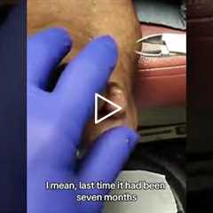 Patient's Hilarious Reason for a Podiatrist Visit