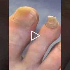 I've heard of the tooth fairy, but never the toenail fairy. I was intimidated about trimming a nail