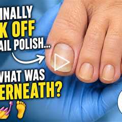 She Finally Took Off the Nail Polish... And What Was Underneath? 💅🦶